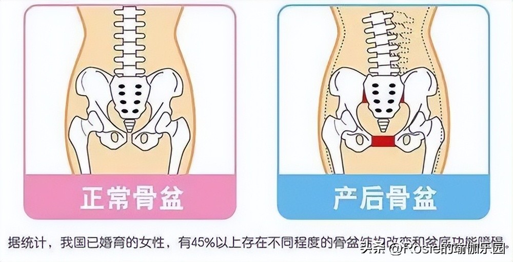 41岁全智贤美上热搜，臀侧凹陷如何改善？每天15分钟重回圆润