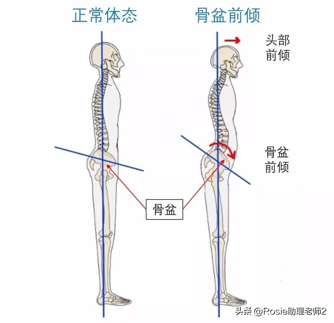 张元英逆天美腿变腿神，O型腿如何变笔直？4步轻松改善