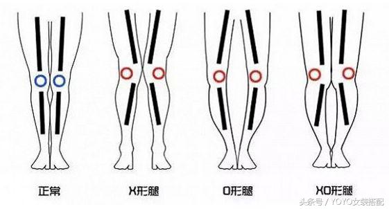腿超细却不直，这篇点名杨幂热巴（一招解救XO型腿）