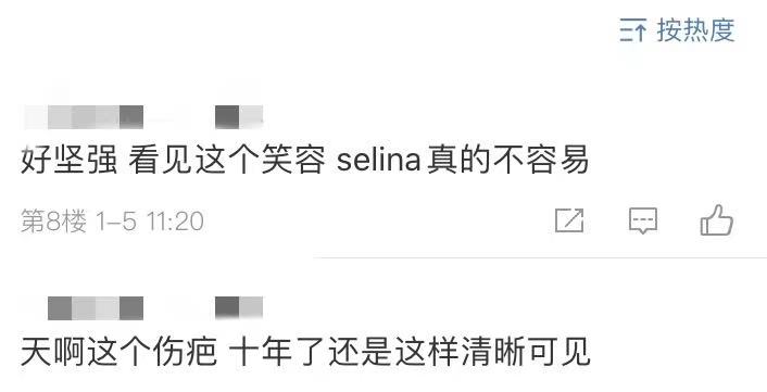 Selina素颜面无血色，街头吃豆花显辛酸，脚踝露伤疤太吓人